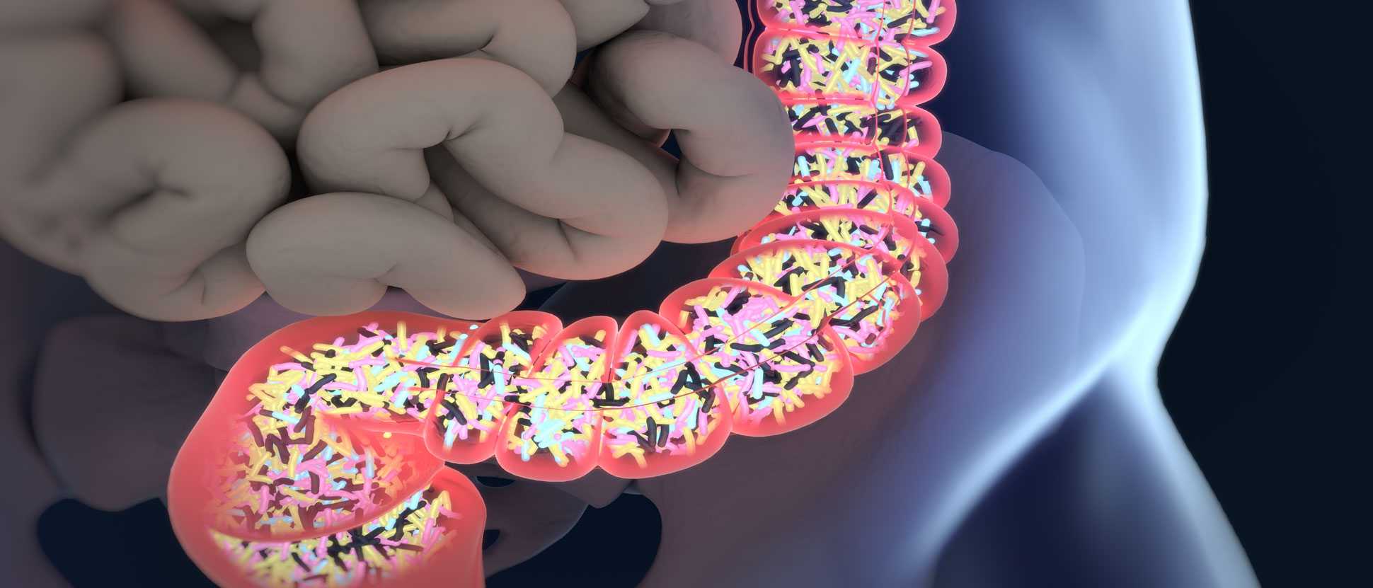 Gut Bacteria Can Dramatically Amplify Cancer Immunotherapy - Blackmores ...